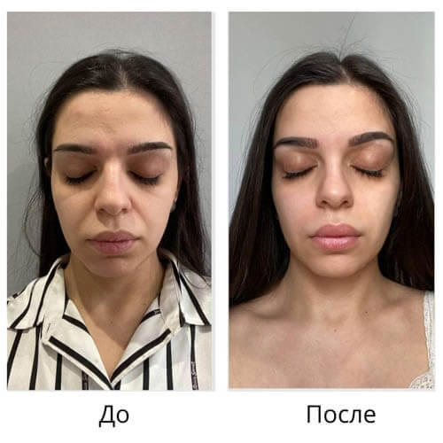 Результат до и после